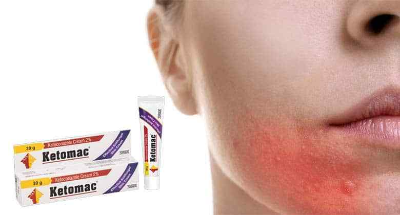 Topical antifungal for lips